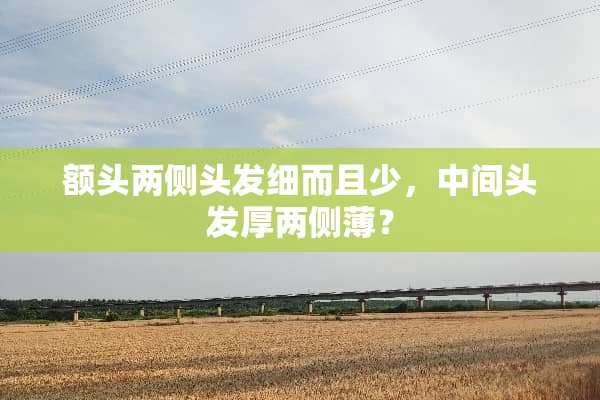额头两侧头发细而且少，中间头发厚两侧薄？
