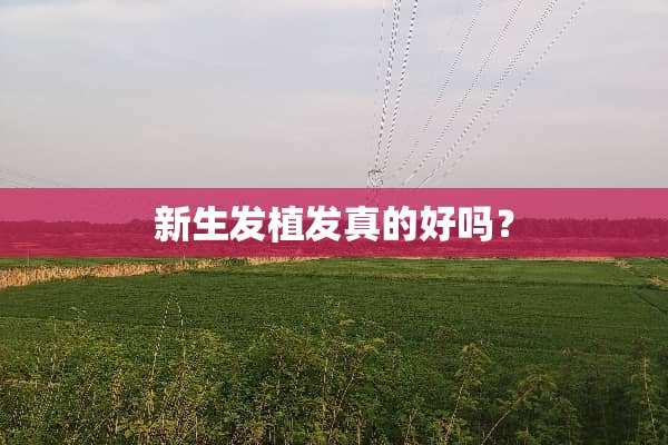 新生发植发真的好吗？
