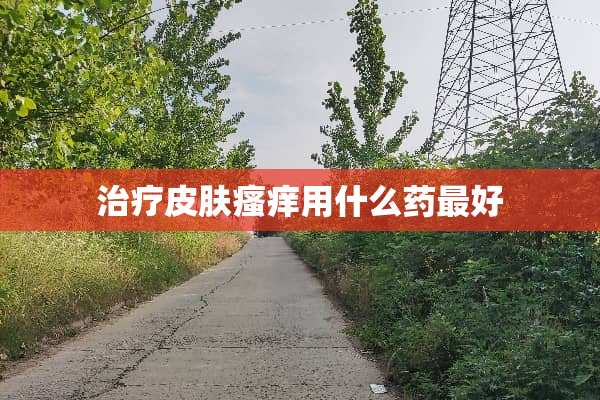 治疗皮肤瘙痒用什么药最好