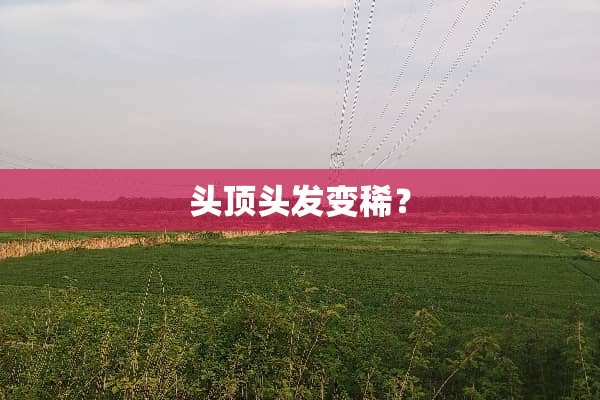 头顶头发变稀？