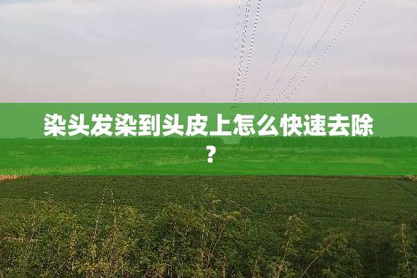 染头发染到头皮上怎么快速去除？