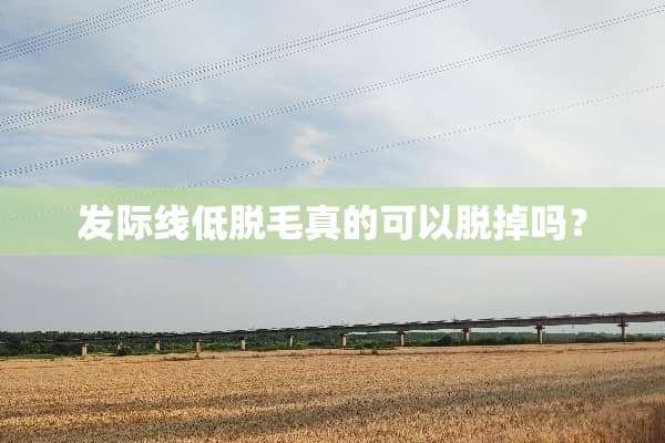 发际线低脱毛真的可以脱掉吗？