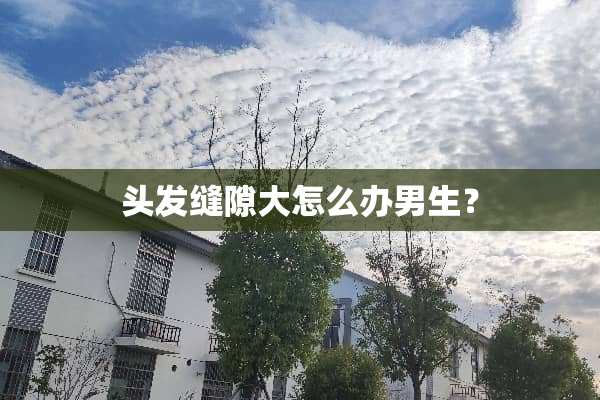 头发缝隙大怎么办男生？