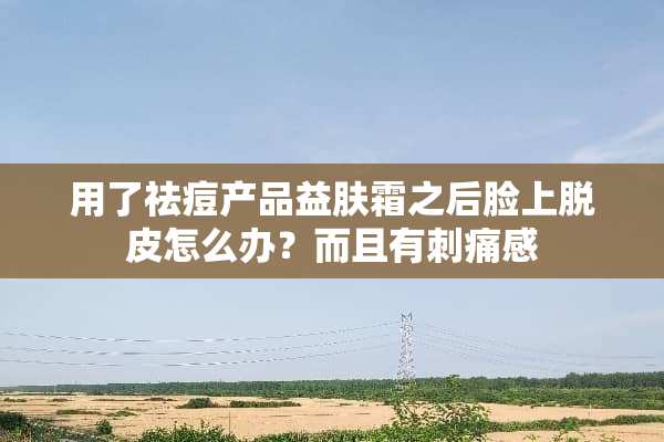用了祛痘产品益肤霜之后脸上脱皮怎么办？而且有刺痛感