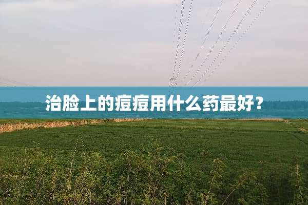 治脸上的痘痘用什么药最好？