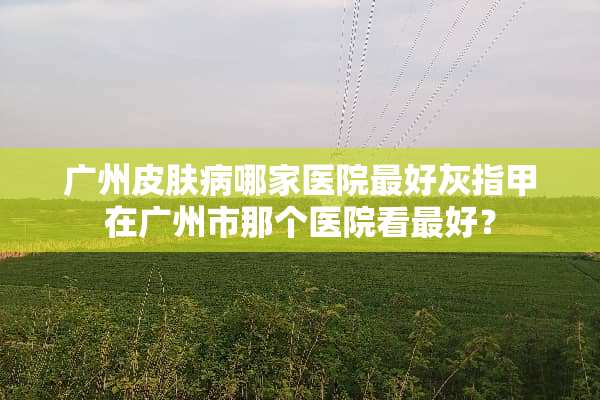 广州皮肤病哪家医院最好灰指甲在广州市那个医院看最好？