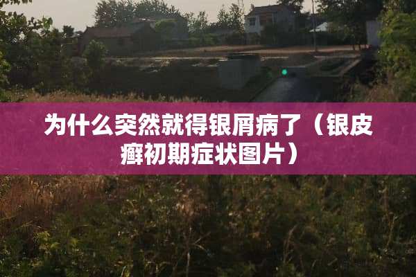 为什么突然就得银屑病了（银皮癣初期症状图片）