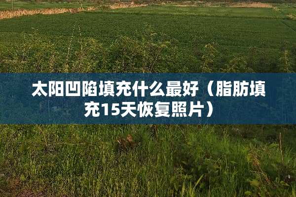 太阳凹陷填充什么最好（脂肪填充15天恢复照片）