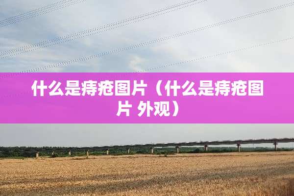 什么是痔疮图片（什么是痔疮图片 外观）