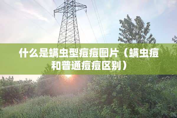 什么是螨虫型痘痘图片（螨虫痘和普通痘痘区别）