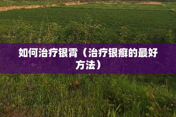 如何治疗银霄（治疗银癣的最好方法）