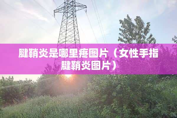 腱鞘炎是哪里疼图片（女性手指腱鞘炎图片）