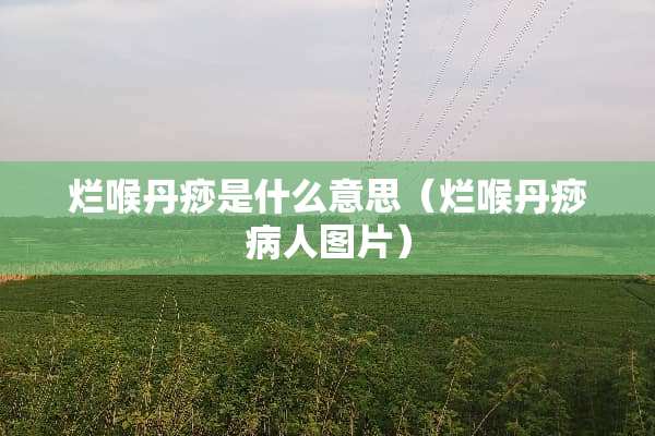 烂喉丹痧是什么意思（烂喉丹痧病人图片）