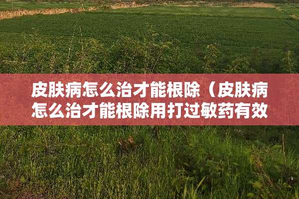 皮肤病怎么治才能根除（皮肤病怎么治才能根除用打过敏药有效果吗）