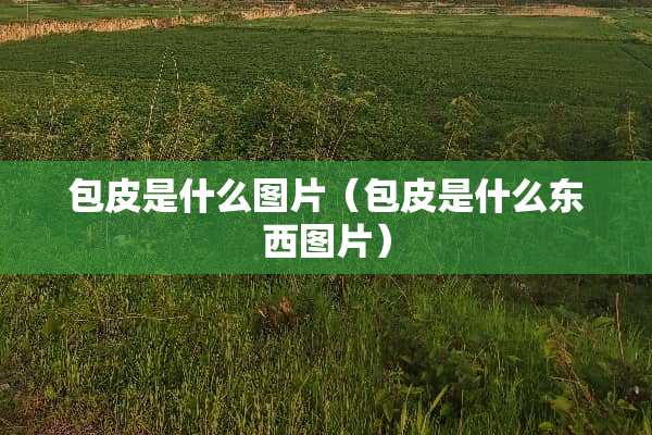 包皮是什么图片（包皮是什么东西图片）