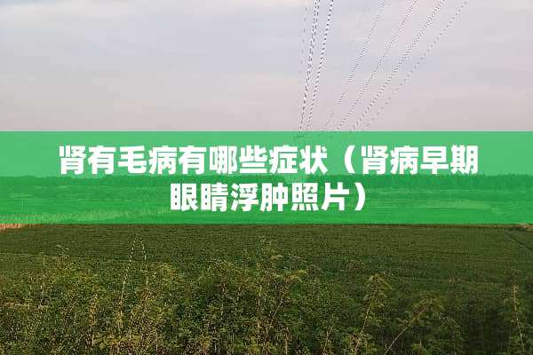 肾有毛病有哪些症状（肾病早期眼睛浮肿照片）
