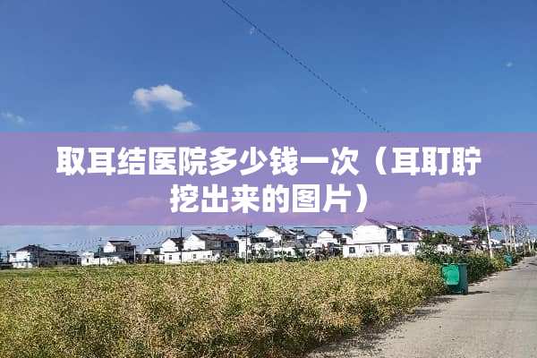 取耳结医院多少钱一次（耳耵聍挖出来的图片）