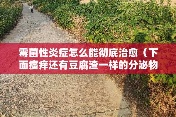 霉菌性炎症怎么能彻底治愈（下面瘙痒还有豆腐渣一样的分泌物）