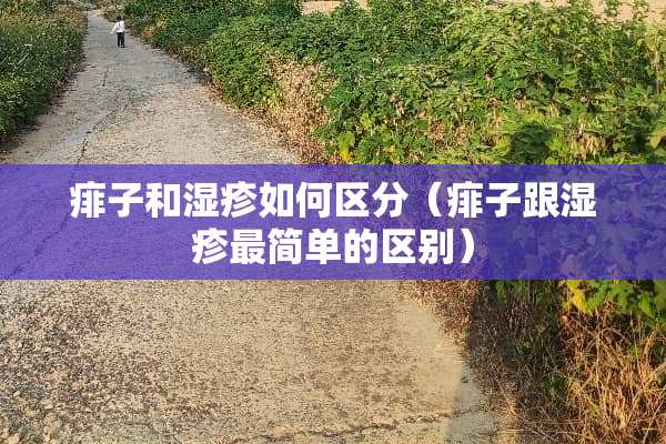 痱子和湿疹如何区分（痱子跟湿疹最简单的区别）