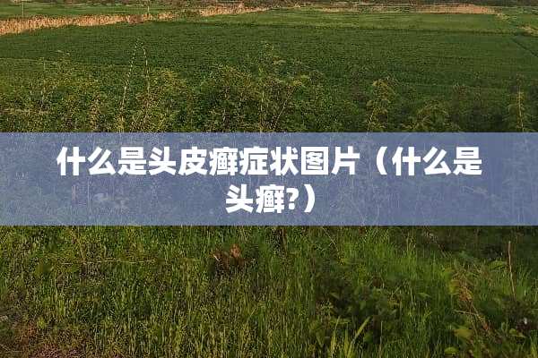 什么是头皮癣症状图片(什么是头癣?) 什么是头皮癣症状图片(什么是头癣?)