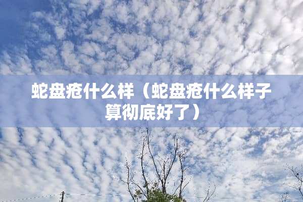蛇盘疮什么样(蛇盘疮什么样子算彻底好了) 蛇盘疮什么样(蛇盘疮什么样子算彻底好了)