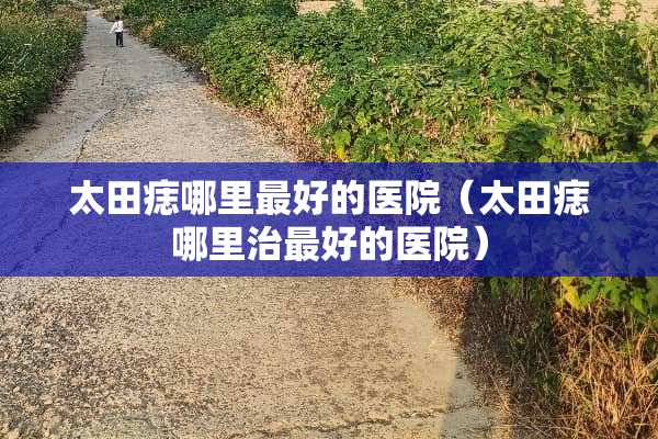 太田痣哪里最好的医院（太田痣哪里治最好的医院）