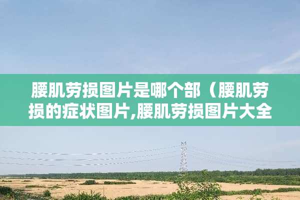 腰肌劳损图片是哪个部（腰肌劳损的症状图片,腰肌劳损图片大全）