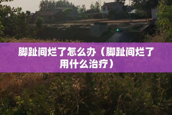 脚趾间烂了怎么办（脚趾间烂了用什么治疗）