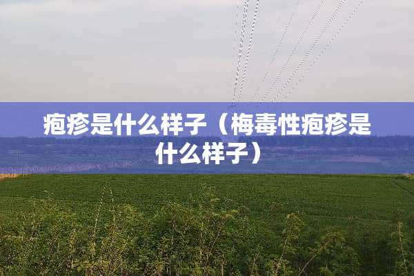 疱疹是什么样子（梅毒性疱疹是什么样子）