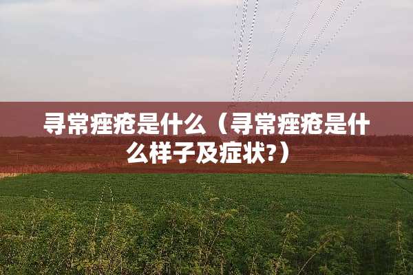 寻常痤疮是什么（寻常痤疮是什么样子及症状?）