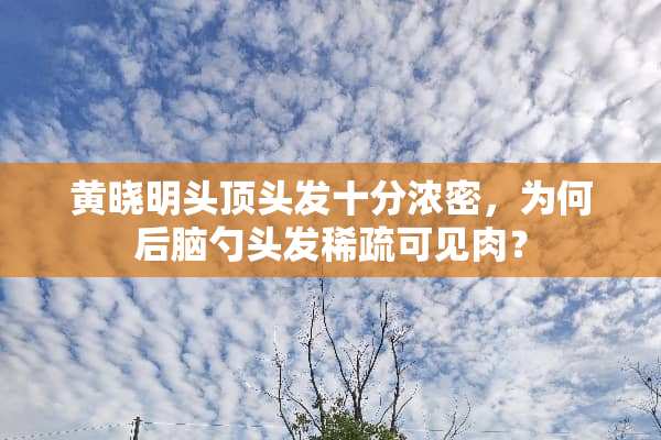 黄晓明头顶头发十分浓密，为何后脑勺头发稀疏可见肉？
