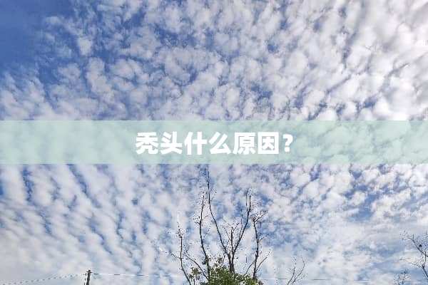 秃头什么原因？