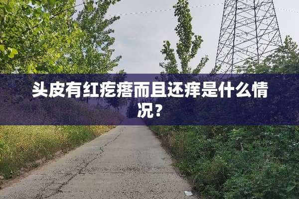头皮有红疙瘩而且还痒是什么情况？