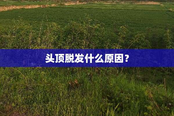 头顶脱发什么原因？