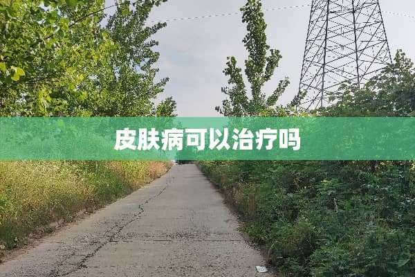 皮肤病可以治疗吗