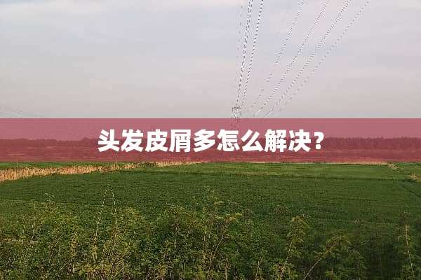 头发皮屑多怎么解决？