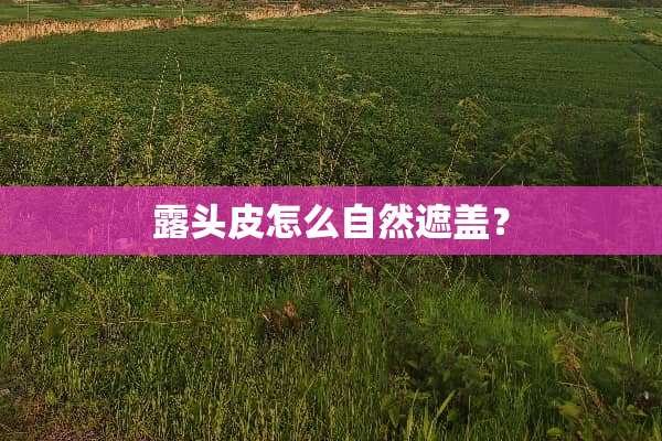 露头皮怎么自然遮盖？