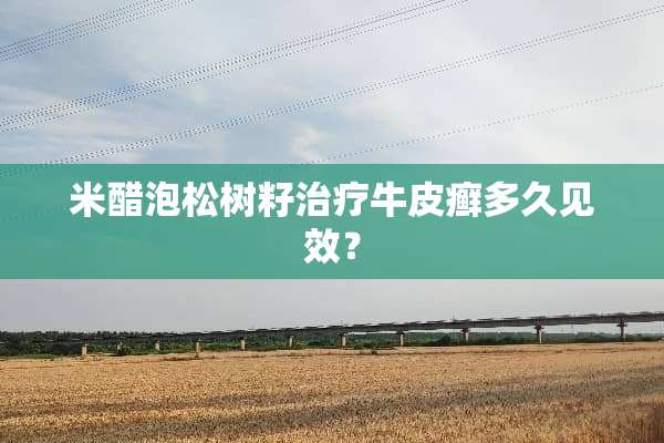 米醋泡松树籽治疗牛皮癣多久见效？